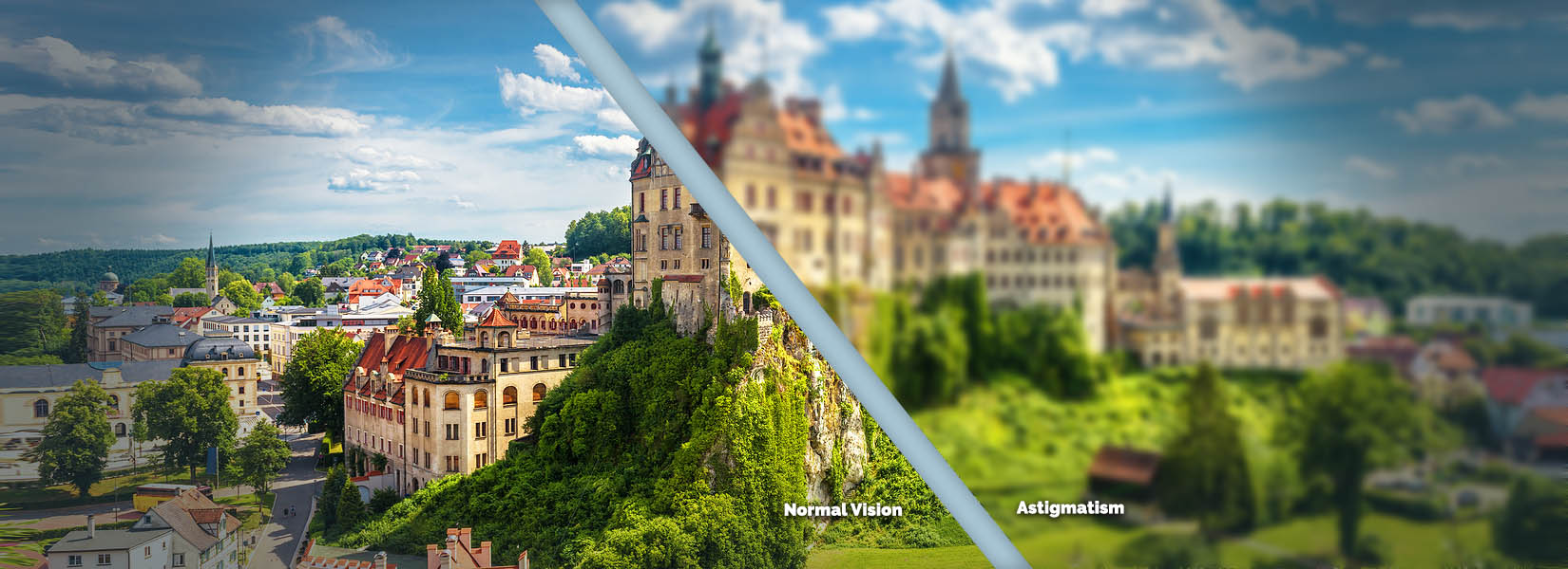 Astigmatism Treatment in Brentwood