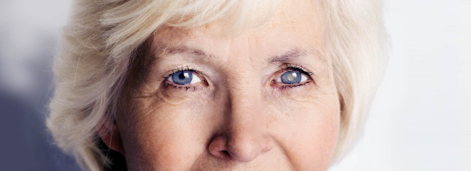 Cataract Surgery in Brentwood